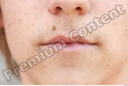 Mouth Head Man Birthmarks Athletic Average Street photo references